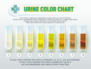 urine color